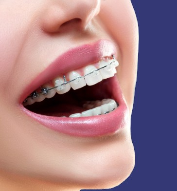 Smiling patient with traditional braces